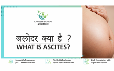 जलोदर (Ascites) क्या है ?