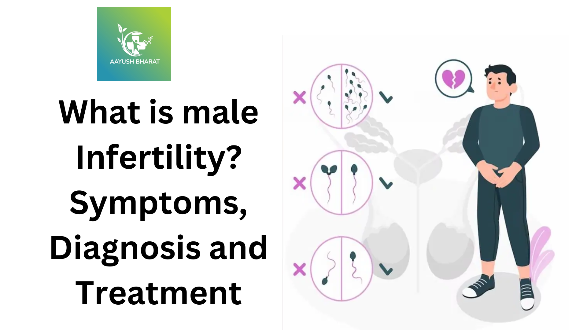 Varicocele: Common Cause of Male Infertility & its Treatment - SCI